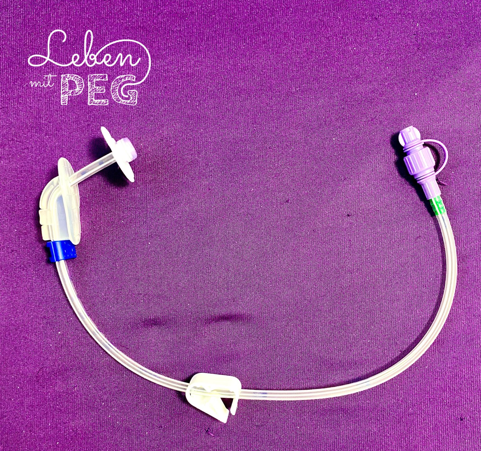 PEG Sonde Aufbau Funktion Einfach Erkl rt Leben Mit PEG