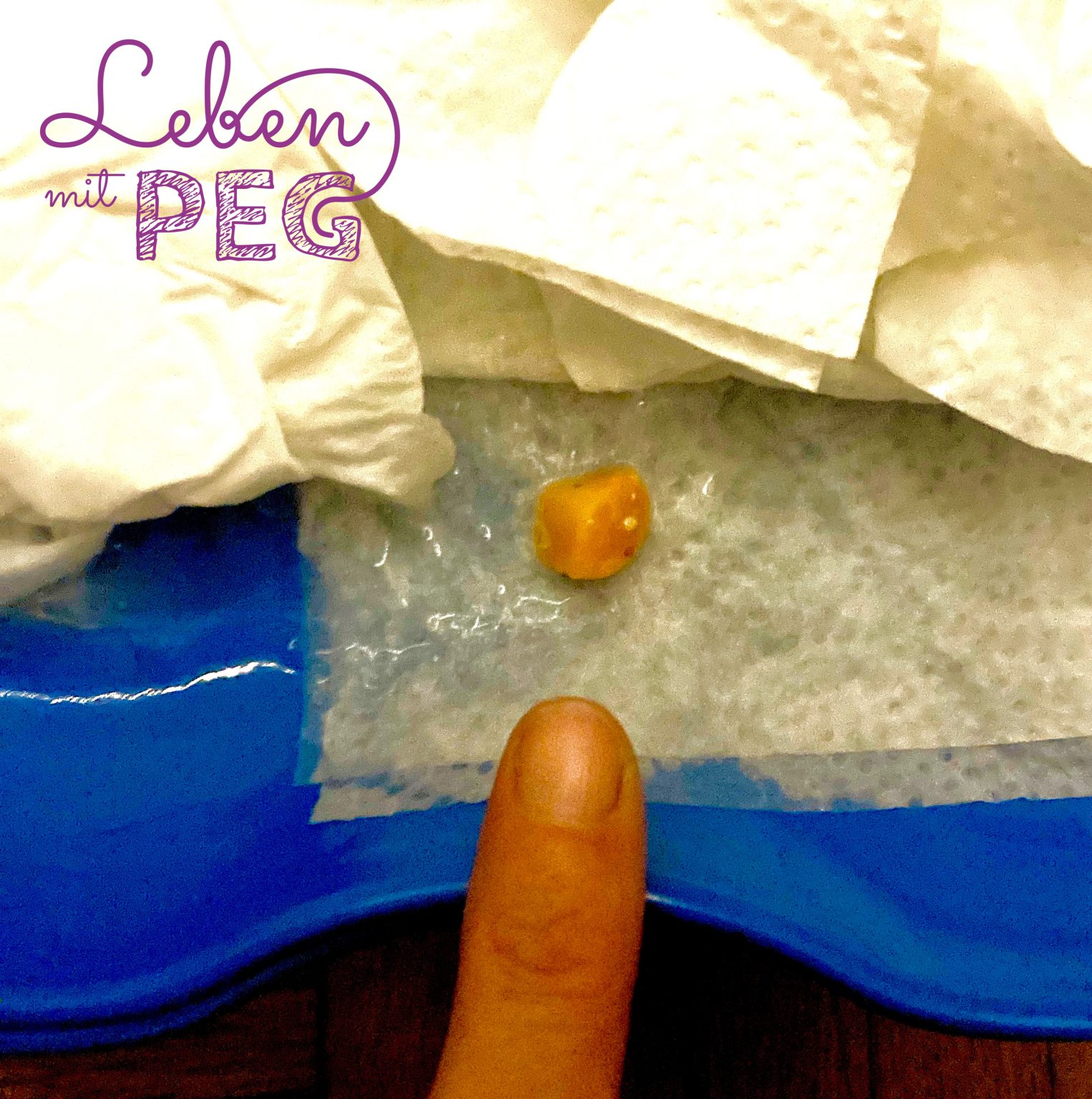 Warum ich für meine PEG dankbar bin Leben mit PEG